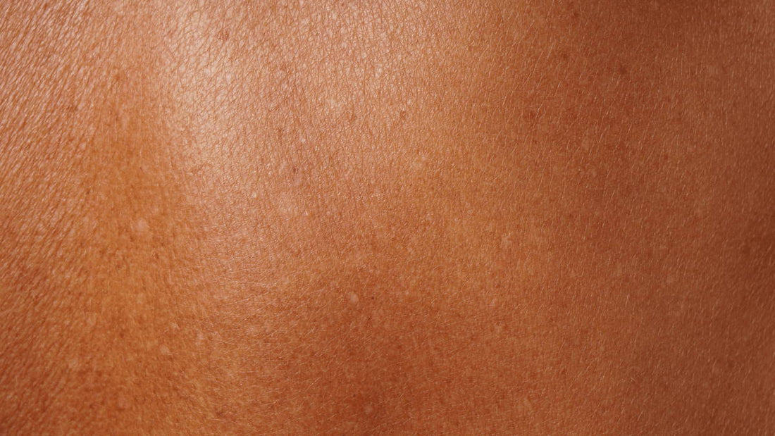 The Skin Barrier Repair Guide