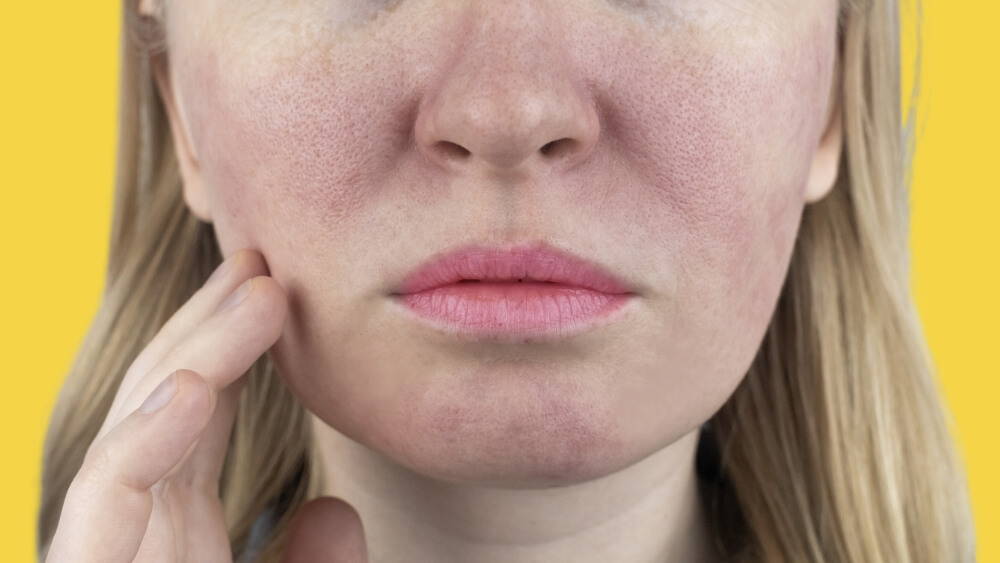 Treat Enlarged Pores With These Expert Tips